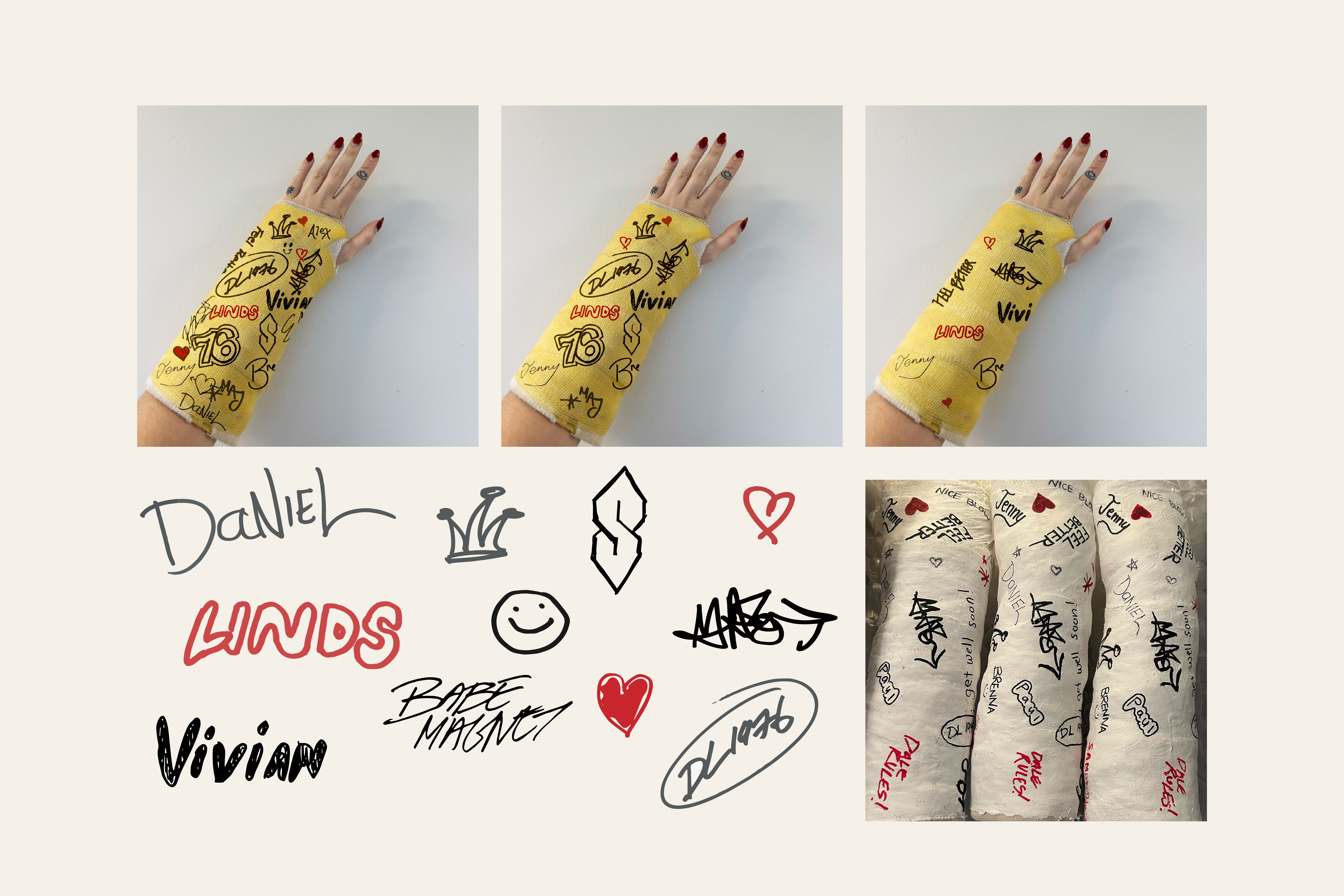 Hand-drawn signatures on Dale's cast, featured prop for episode 5